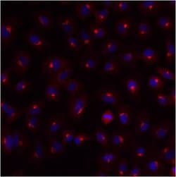 Invitrogen TGN46 Polyclonal Antibody 100 &mu;g; Unconjugated:Antikroppar