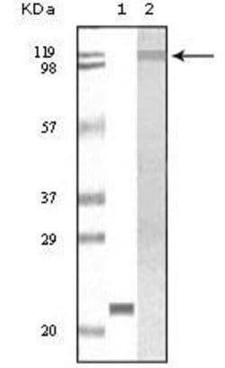Invitrogen TYK2 Monoclonal Antibody (8G8E9, 8G9H5,8G8B3) 100 &mu;L; Unconjugated:Antibodies,