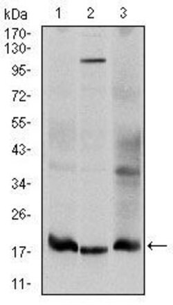 Invitrogen UBC9 Monoclonal Antibody (1B10) 100 &mu;L; Unconjugated:Antibodies,