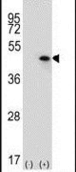 USP12 Rabbit anti-Human, Polyclonal, Invitrogen 400 &mu;L; Unconjugated:Antibodies,
