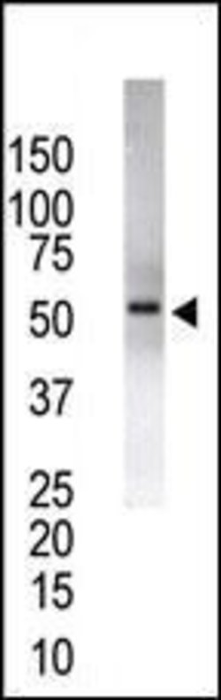 USP14 Rabbit anti-Human, Polyclonal, Invitrogen 400 &mu;L; Unconjugated:Antibodies,