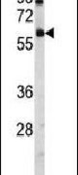 USP14 Rabbit anti-Human, Polyclonal, Invitrogen 400 &mu;L; Unconjugated:Antibodies,