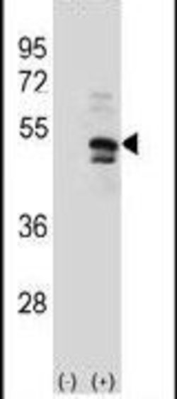 USP14 Rabbit anti-Human, Polyclonal, Invitrogen 400 &mu;L; Unconjugated:Antibodies,