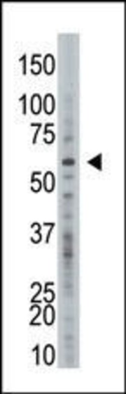USP21 Rabbit anti-Human, Polyclonal, Invitrogen 400 &mu;L; Unconjugated:Antibodies,