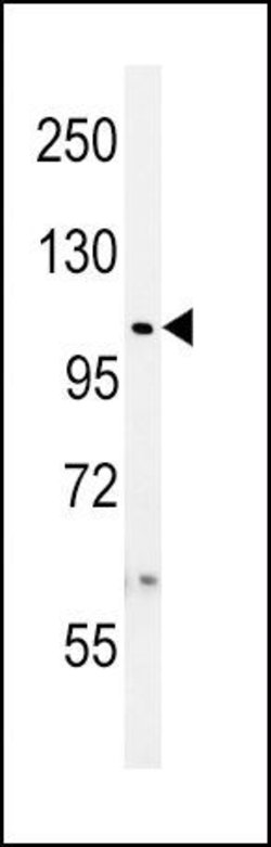 USP8 Rabbit anti-Human, Polyclonal, Invitrogen 400 &mu;L; Unconjugated:Antibodies,