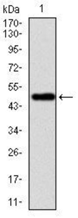VAV1 Monoclonal Antibody (2E11):Antibodies, Monoclonal