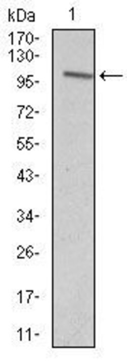 VAV1 Monoclonal Antibody (2E11):Antibodies, Monoclonal