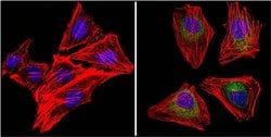 VEGF Monoclonal Antibody (VG1), Invitrogen 500 &mu;L; Unconjugated:Antibodies,