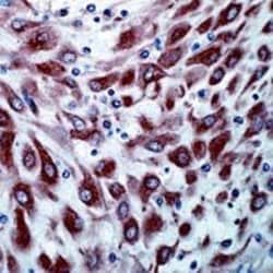 Invitrogen VEGF Receptor 3 Polyclonal Antibody 1 mL; Unconjugated:Antibodies,
