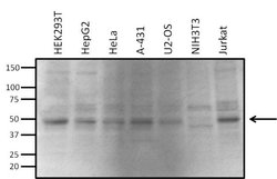 Invitrogen VRK1 Monoclonal Antibody (1F6) 100 &mu;g; Unconjugated:Anticuerpos