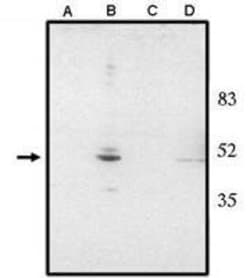 Invitrogen CHX10 Polyclonal Antibody 250 &mu;g; Unconjugated:Antibodies,
