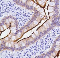 Invitrogen Villin Monoclonal Antibody (SP145) 500 &mu;L; Unconjugated:Antibodies,
