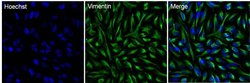Vimentin Monoclonal Antibody (SP20), Invitrogen 500 &mu;L | Buy Online | Invitrogen | Fisher Scientific