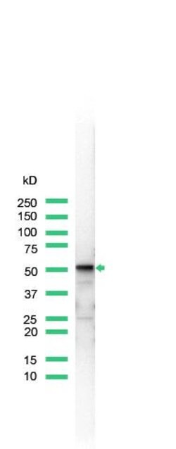 Invitrogen Vimentin Monoclonal Antibody (SP20) 500 &mu;L; Unconjugated:Antibodies,