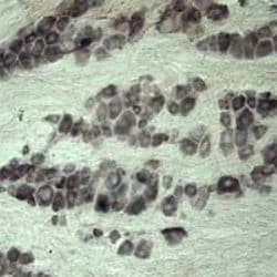 VPS45 Polyclonal Antibody, Invitrogen 100 &mu;L | Buy Online | Invitrogen | Fisher Scientific