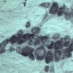 VPS45 Polyclonal Antibody, Invitrogen 100 &mu;L | Buy Online | Invitrogen | Fisher Scientific