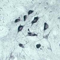 VPS45 Polyclonal Antibody, Invitrogen 100 &mu;L | Buy Online | Invitrogen | Fisher Scientific