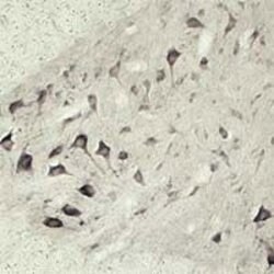 VPS45 Polyclonal Antibody, Invitrogen 100 &mu;L | Buy Online | Invitrogen | Fisher Scientific