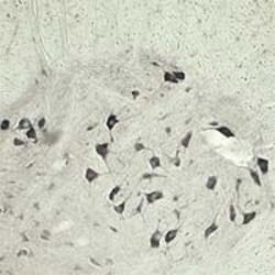 VPS45 Polyclonal Antibody, Invitrogen 100 &mu;L | Buy Online | Invitrogen | Fisher Scientific