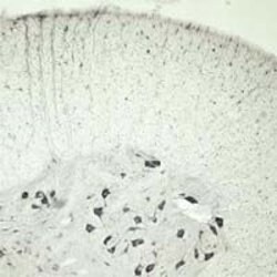 VPS45 Polyclonal Antibody, Invitrogen 100 &mu;L | Buy Online | Invitrogen | Fisher Scientific