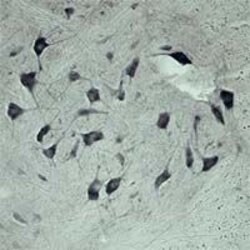 VPS45 Polyclonal Antibody, Invitrogen 100 &mu;L | Buy Online | Invitrogen | Fisher Scientific