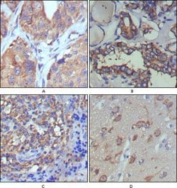 Invitrogen WNT5A Monoclonal Antibody (6F2) 100 &mu;L; Unconjugated:Antibodies,