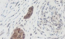 Invitrogen WNT1 Polyclonal Antibody 100 &mu;g; Unconjugated:Antibodies,