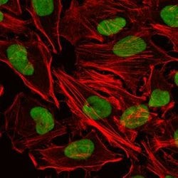 Invitrogen Ku80 Monoclonal Antibody (5C5) 100 &mu;L; Unconjugated:Antibodies,