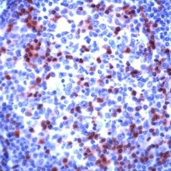 Zap-70 Polyclonal Antibody, Invitrogen 500 &mu;L; Unconjugated:Antibodies,