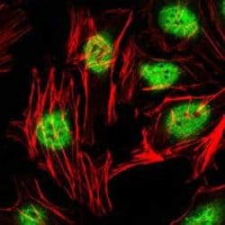 Invitrogen PLZF Monoclonal Antibody (5B3) 100 &mu;L; Unconjugated:Antibodies,
