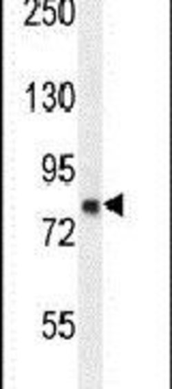 ZFYVE28 Rabbit anti-Human, Mouse, Polyclonal, Invitrogen 400 μL; Unconjugated:Antibodies,