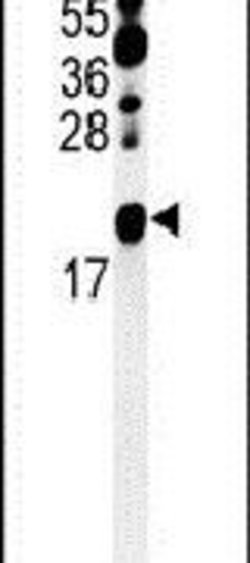 ZNF9 Rabbit anti-Human, Mouse, Polyclonal, Invitrogen 400 &mu;L; Unconjugated:Antibodies,