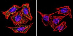 Invitrogen alpha Adaptin Monoclonal Antibody (AP6) 100 &mu;L; Unconjugated:Antibodies,