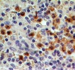Invitrogen CCR1 Polyclonal Antibody 100 &mu;g; Unconjugated:Antibodies,