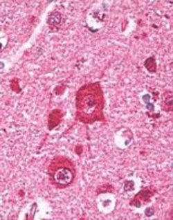 FNBP1 Rabbit anti-Human, Mouse, Rat, Polyclonal, Invitrogen 100 &mu;g;