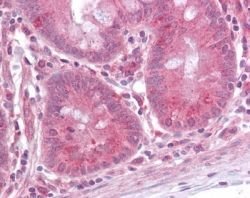 ERK1 Polyclonal Antibody, Invitrogen 100 &mu;g | Buy Online | Thermo Scientific | Fisher Scientific