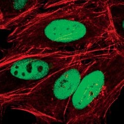 Invitrogen&trade;&nbsp;c-Jun Monoclonal Antibody (C.238.2)