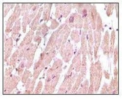Invitrogen Cardiac Troponin I Monoclonal Antibody (3A10A12,5C3A7) 100 &mu;L;