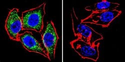 Invitrogen eNOS Polyclonal Antibody 100 &mu;L; Unconjugated:Antibodies,