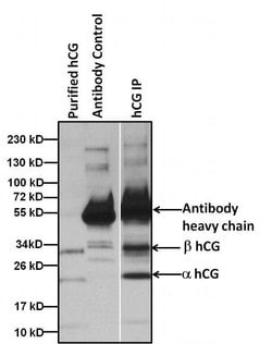 Invitrogen hCG Monoclonal Antibody (SC1) 100 &mu;g; Unconjugated:Antibodies,