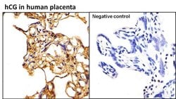 Invitrogen hCG Monoclonal Antibody (3002) 1 mg; Unconjugated:Antibodies,