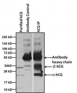 Invitrogen hCG Monoclonal Antibody (3002) 1 mg; Unconjugated:Antibodies,