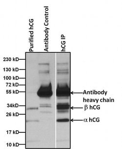 Invitrogen hCG Monoclonal Antibody (SC2) 1 mg | Buy Online | Invitrogen&trade; | Fisher Scientific