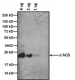 Invitrogen hCG Monoclonal Antibody (34P2C2) 1 mg; Unconjugated:Antibodies,