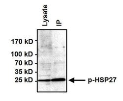 Phospho-HSP27 (Ser85) Rabbit anti-Human, Rat, Polyclonal, Invitrogen 100 &mu;g | Buy Online | Invitrogen | Fisher Scientific