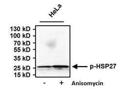 Phospho-HSP27 (Ser85) Rabbit anti-Human, Rat, Polyclonal, Invitrogen 100 &mu;g | Buy Online | Invitrogen | Fisher Scientific