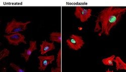 Phospho-Rb (Ser608) Monoclonal Antibody (51B7), Invitrogen 500 &mu;L | Buy Online | Invitrogen | Fisher Scientific