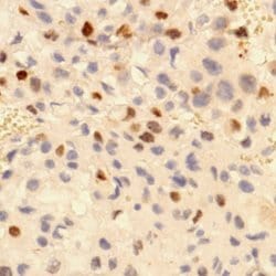 Invitrogen p57 Kip2 Polyclonal Antibody 500 &mu;L; Unconjugated:Antibodies,
