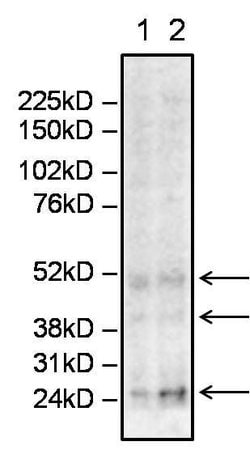 Invitrogen Sialosyl-Tn Antigen Monoclonal Antibody (STn 219) 500 &mu;L;