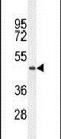 TMEM229A Rabbit anti-Human, Mouse, Polyclonal, Invitrogen 400 &mu;L; Unconjugated:Antibodies,